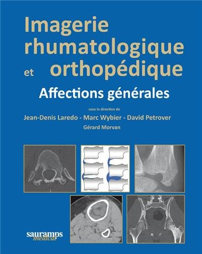 Imagerie rhumatologique et orthopédique. Vol. 1. Affections générales