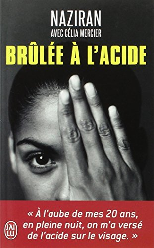 Brûlée à l'acide : témoignage