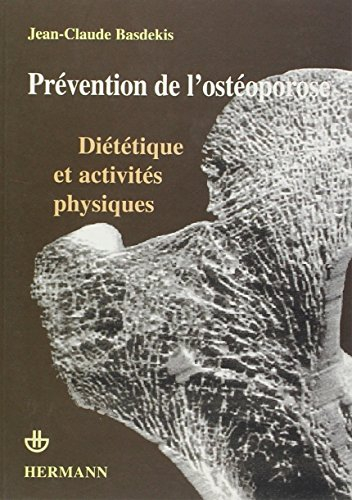 Prévention de l'ostéoporose : diététique et activités physiques