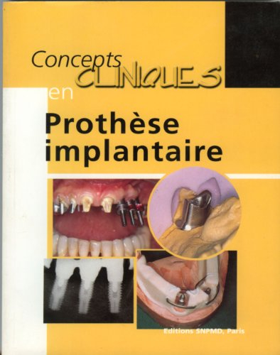 Concepts cliniques en prothèse implantaire