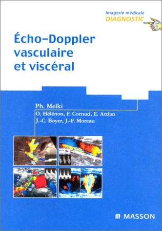 Echo-Doppler vasculaire et viscéral