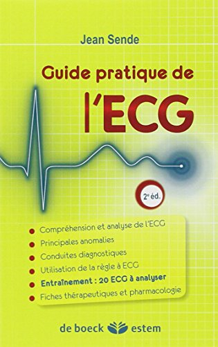Guide pratique de l'ECG