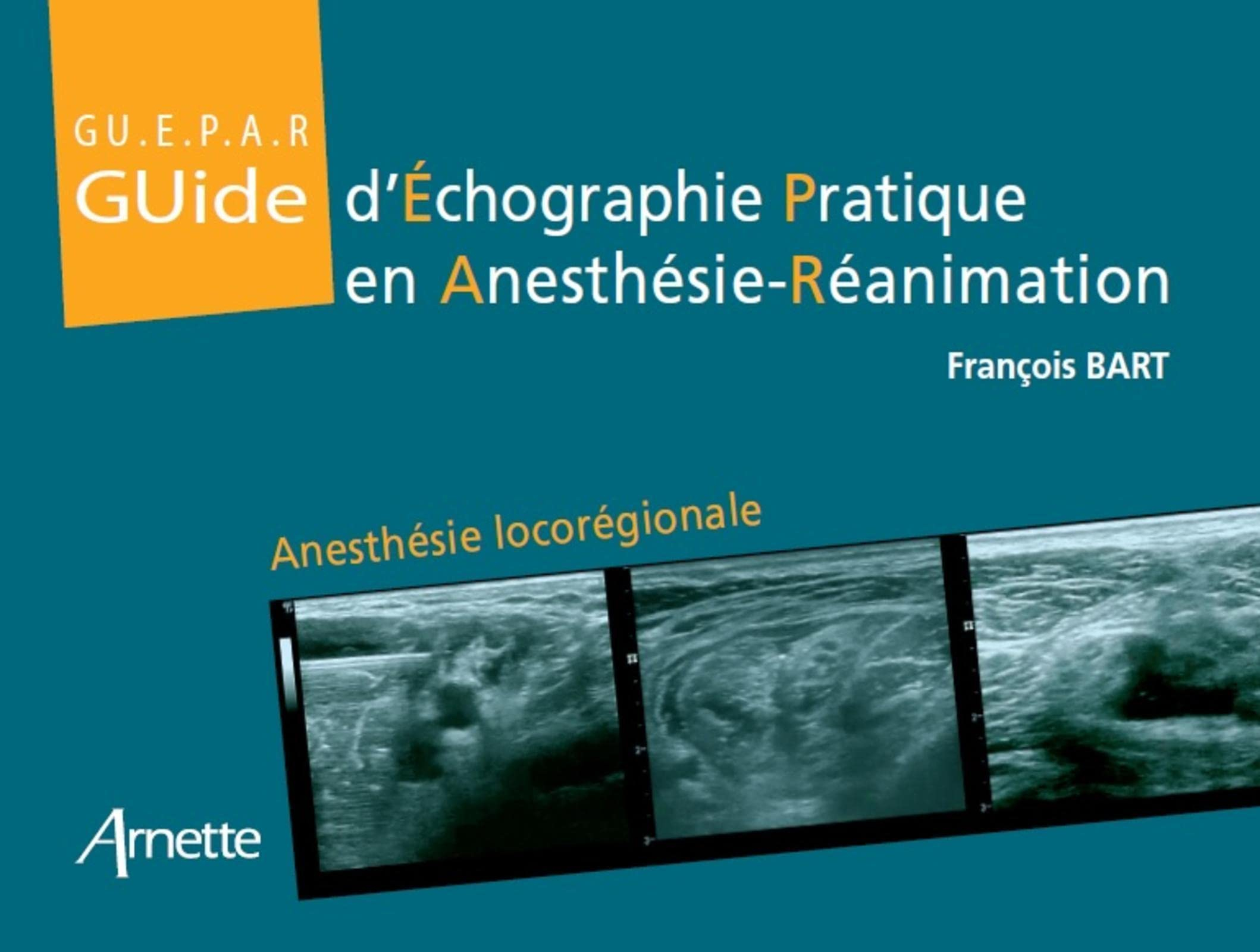 Guide d'échographie pratique en anesthésie-réanimation : anesthésie locorégionale