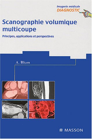 Scanographie volumique multicoupe. Imagerie médicale : diagnostic