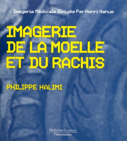 L'Imagerie de la moelle et du rachis