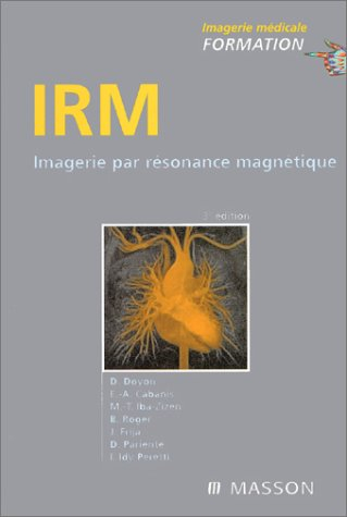 IRM : imagerie par résonance magnétique