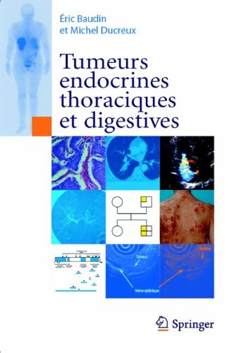 Tumeurs endocrines thoraciques et digestives
