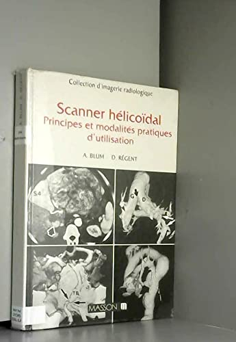 Scanner hélicoïdal : nouveaux principes scanographiques, applications cliniques
