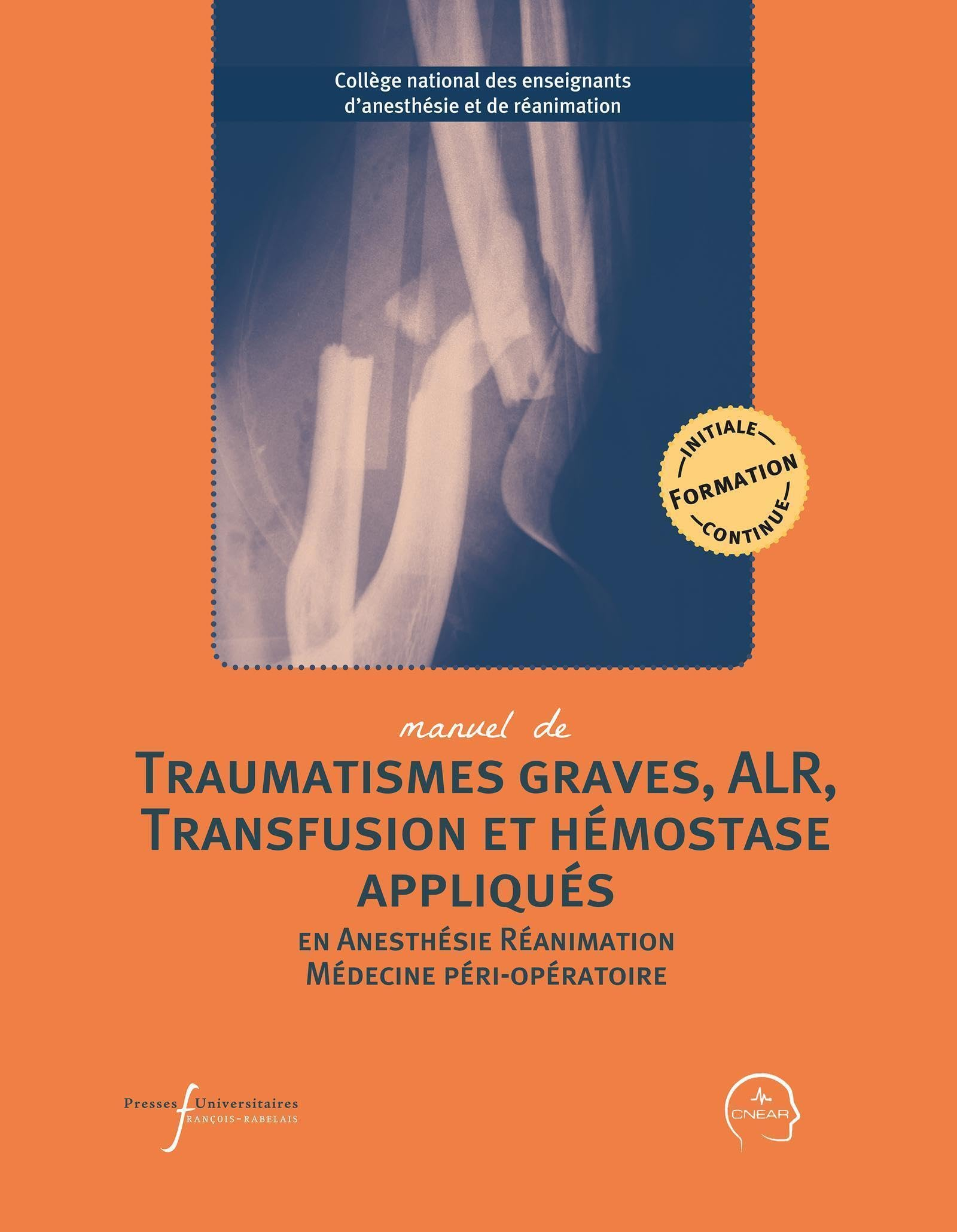 Manuel de traumatismes graves, ALR, transfusion et hémostase appliqués en anesthésie, réanimation, m