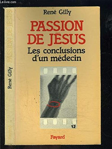 Passion de Jésus : les conclusions d'un médecin