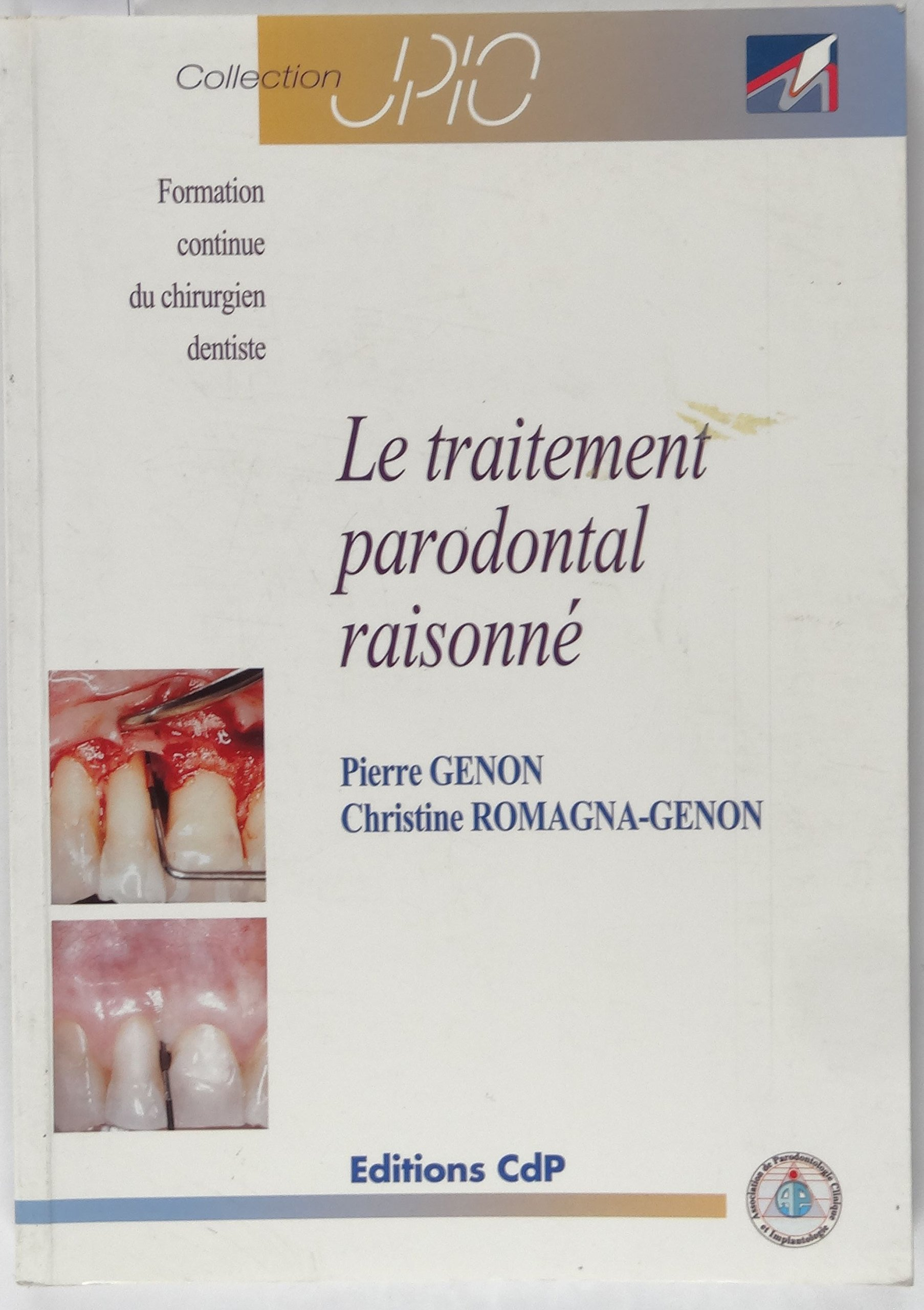 Le traitement parodontal raisonné