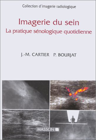 Imagerie du sein : la pratique gynécologique quotidienne