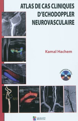 Atlas de cas cliniques d'échodoppler neurovasculaire