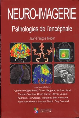 Neuro-imagerie : pathologies de l'encéphale