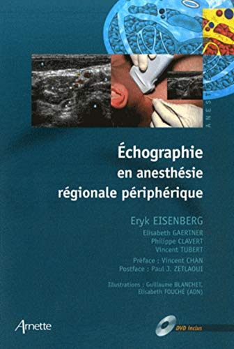 Echographie en anesthésie régionale périphérique