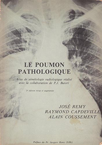le poumon pathologique : atlas de séméiologie radiologique
