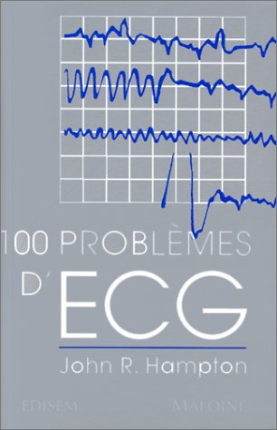 100 problèmes d'ECG