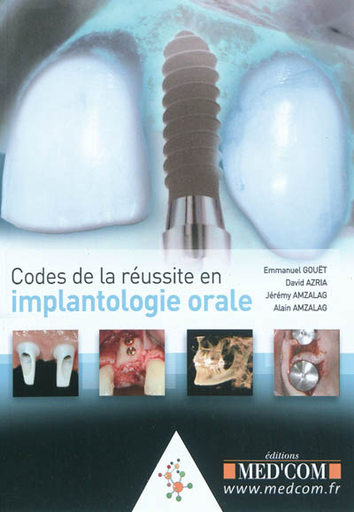 Codes de la réussite en implantologie orale