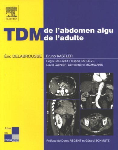 TDM de l'abdomen aigu de l'adulte