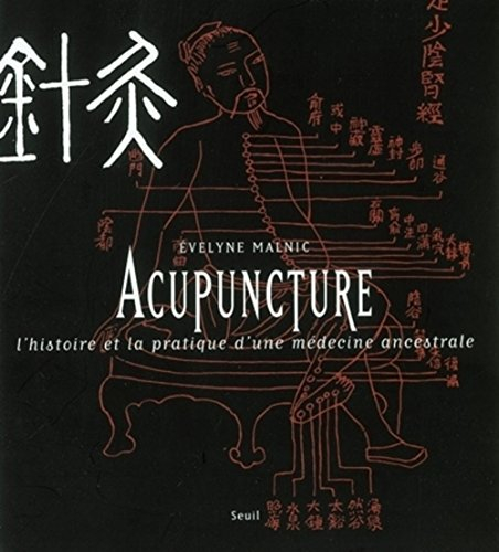 L'acupuncture : l'histoire et la pratique d'une médecine ancestrale