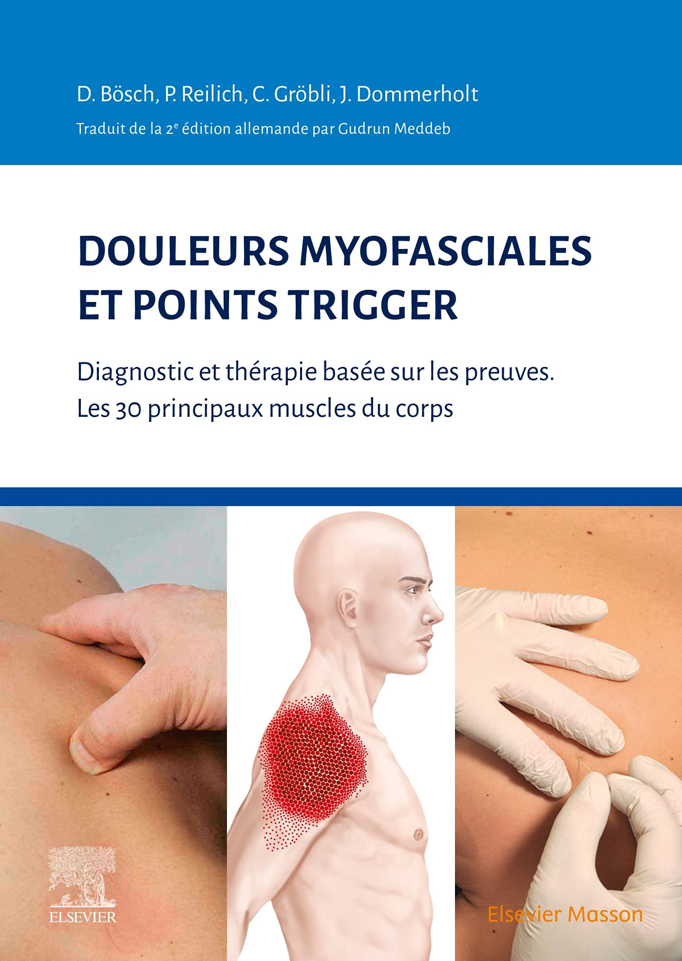 Douleurs myofasciales et points trigger : diagnostic et thérapie basée sur les preuves : les 30 prin