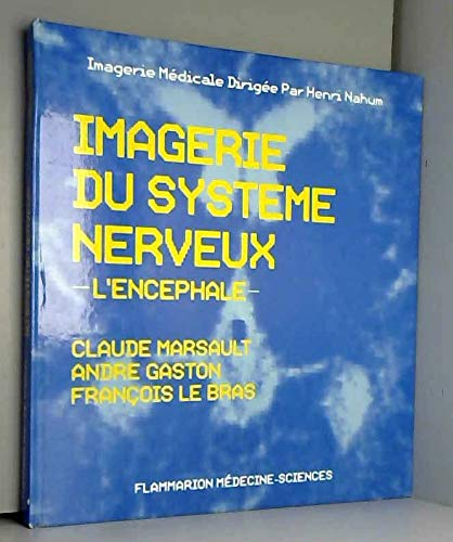 Imagerie du système nerveux: L'encéphale