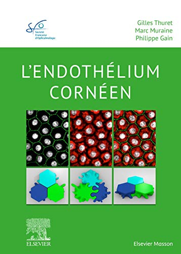 Lendothélium cornéen