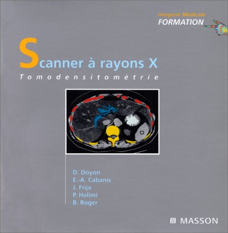 Scanners à rayons X : tomodensitométrie