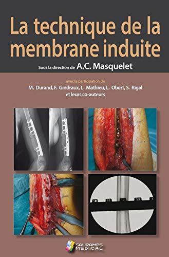 La technique de la membrane induite : principes, pratiques et perspectives
