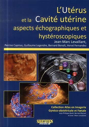 L'utérus et la cavité utérine : aspects échographiques et hystéroscopiques