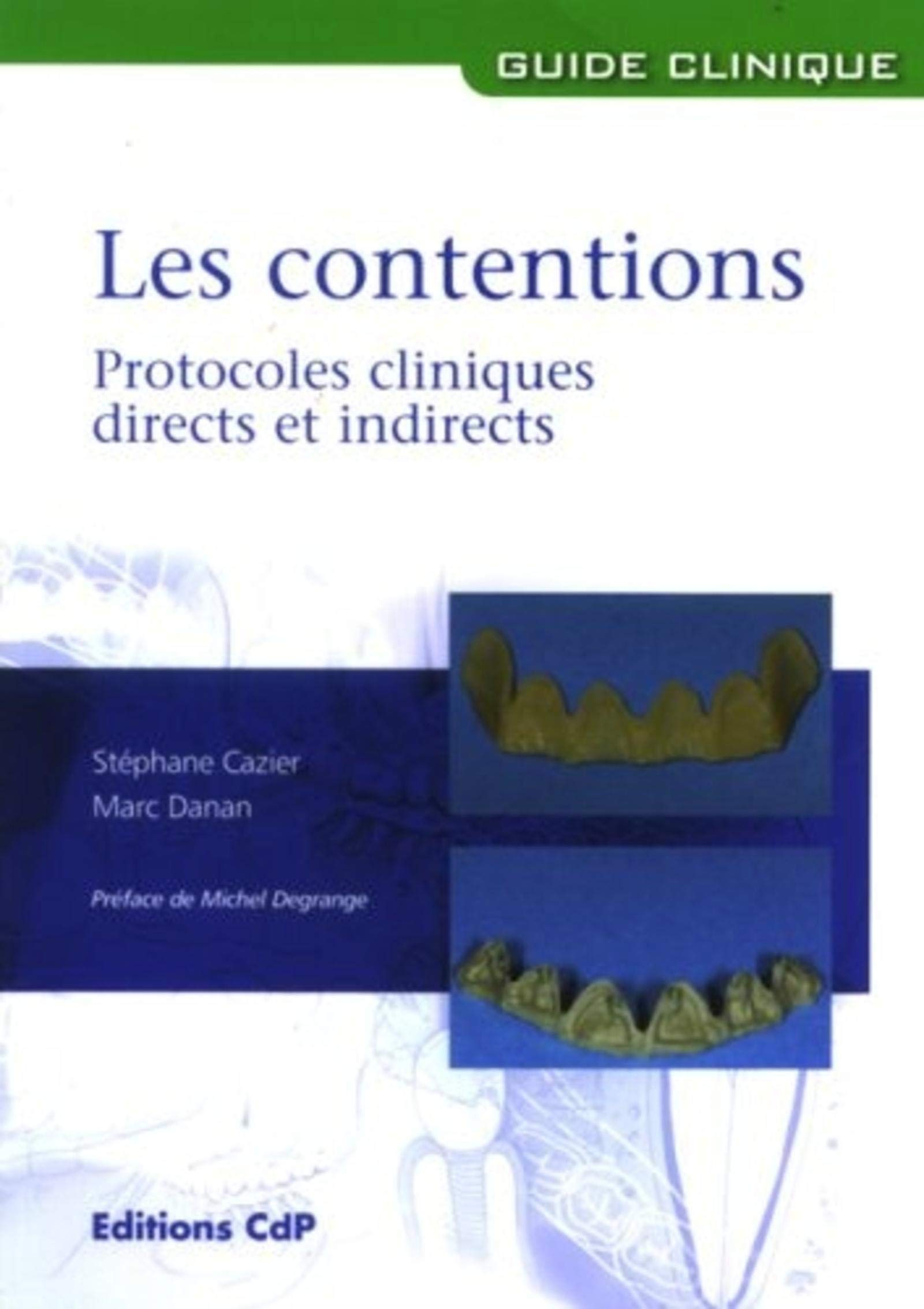 Les contentions : protocoles cliniques directs et indirects