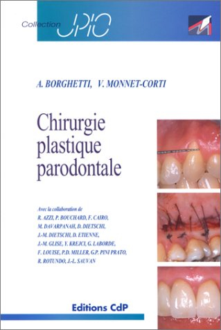 Chirurgie plastique parodontale