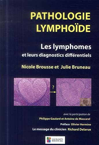 Pathologie lymphoïde : les lymphomes et leurs diagnostics différentiels