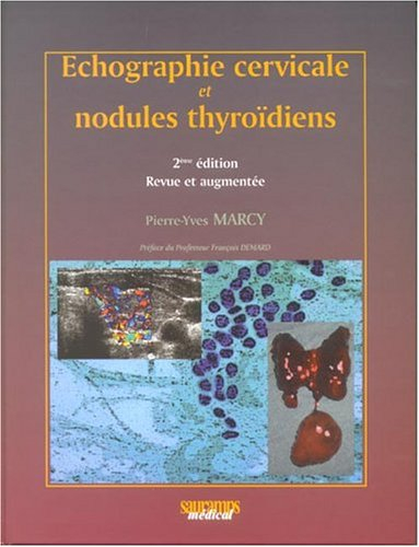 Echographie cervicale et nodules thyroïdiens