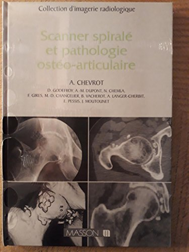 Scanner spiralé et pathologie ostéo-articulaire