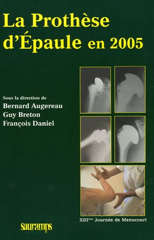 La prothèse d'épaule en 2005