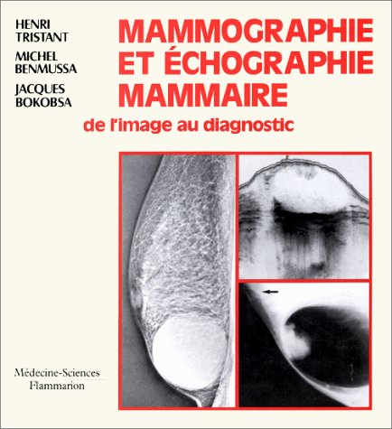 Mammographie et échographie mammaire : de l'image au diagnostic