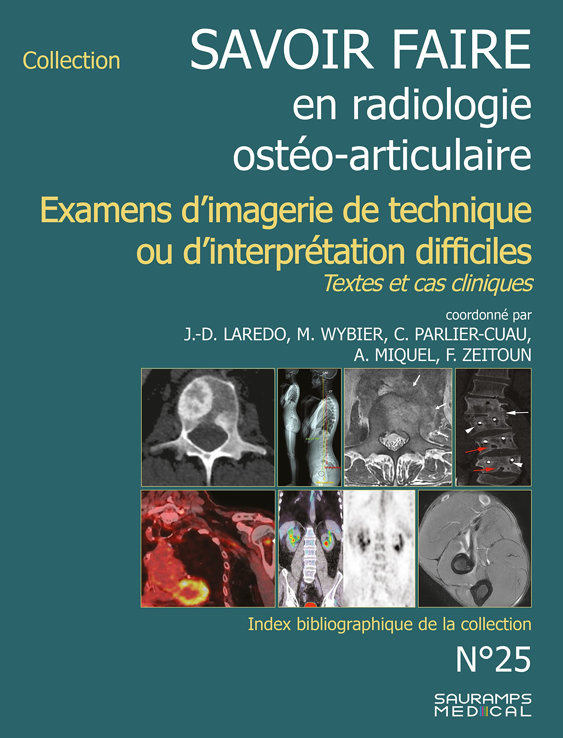 Savoir faire en radiologie ostéo-articulaire. Vol. 25. Examens d'imagerie de technique ou d'interpré