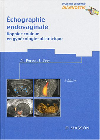 Echographie endovaginale : Doppler couleur en gynécologie-obstétrique
