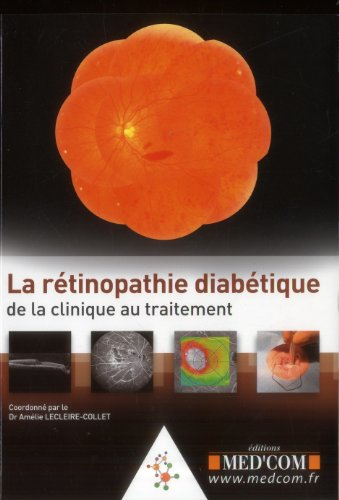 La rétinopathie diabétique : de la clinique au traitement