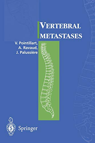 Vertebral Metastases