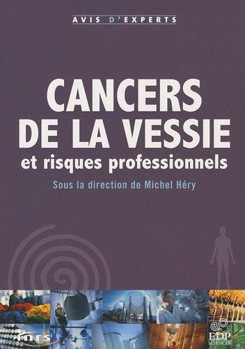 Cancers de la vessie et risques professionnels