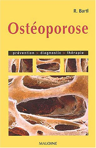 L'ostéoporose : prévention, diagnostic, traitement