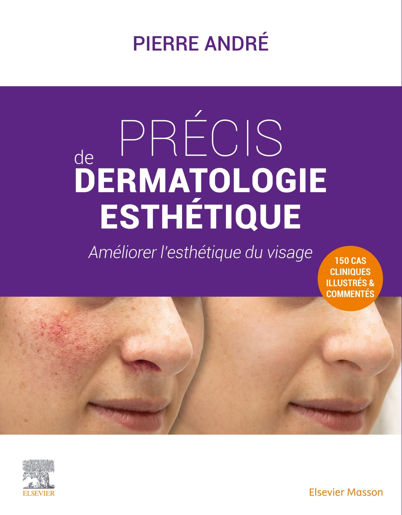Précis de dermatologie esthétique : améliorer l'esthétique du visage : 150 cas cliniques illustrés e
