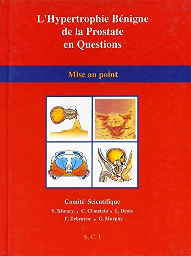 l'hypertrophie bénigne de la prostate en questions. mise au point.
