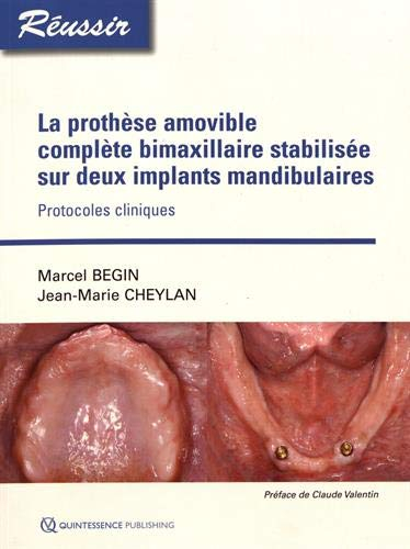 La prothèse amovible complète bimaxilliaire stabilisée sur deux implants mandibulaires : protocoles 