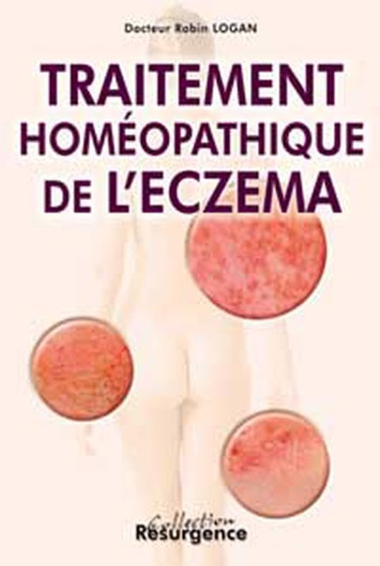 Le traitement homéopathique de l'eczéma