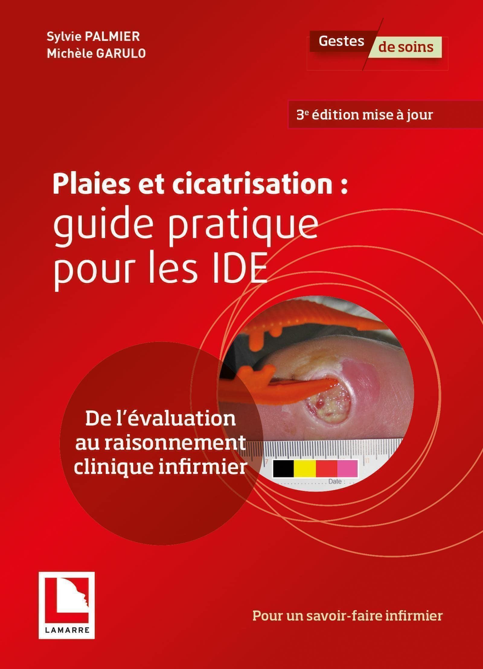 Plaies et cicatrisation : guide pratique pour les IDE : de l'évaluation au raisonnement clinique inf