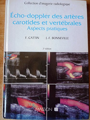 Echo-doppler des arteres carotides et vertebrales: Aspects pratiques