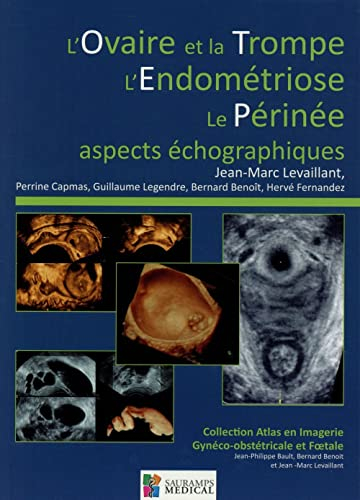 L'ovaire et la trompe, l'endométriose, le périnée : aspects échographiques